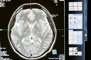 Cómo entrenar tu cerebro para recordar más sueños